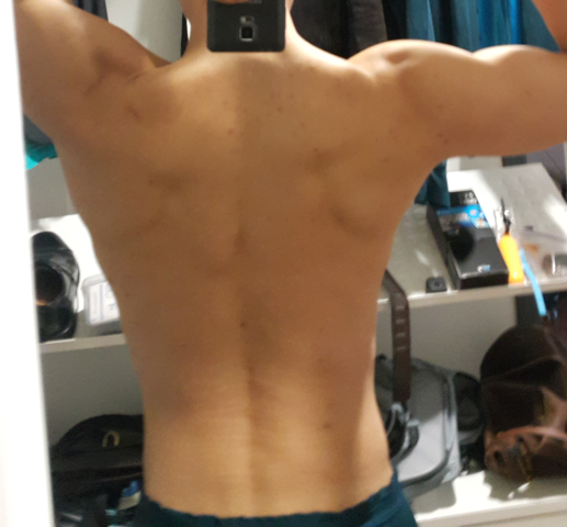 Back